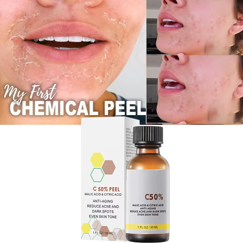 Salicylic Acid Cleanser - Con ácido málico y ácido cítrico