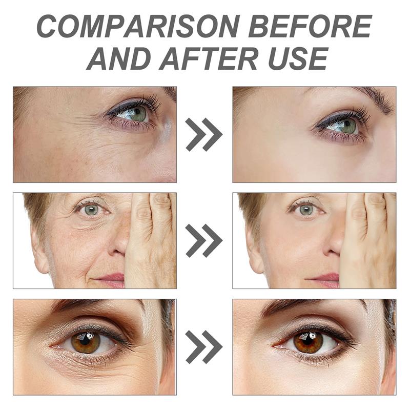 Suero Facial con Retinol para  - The Ordinary Serum Hyaluronic Acid reseña y precio