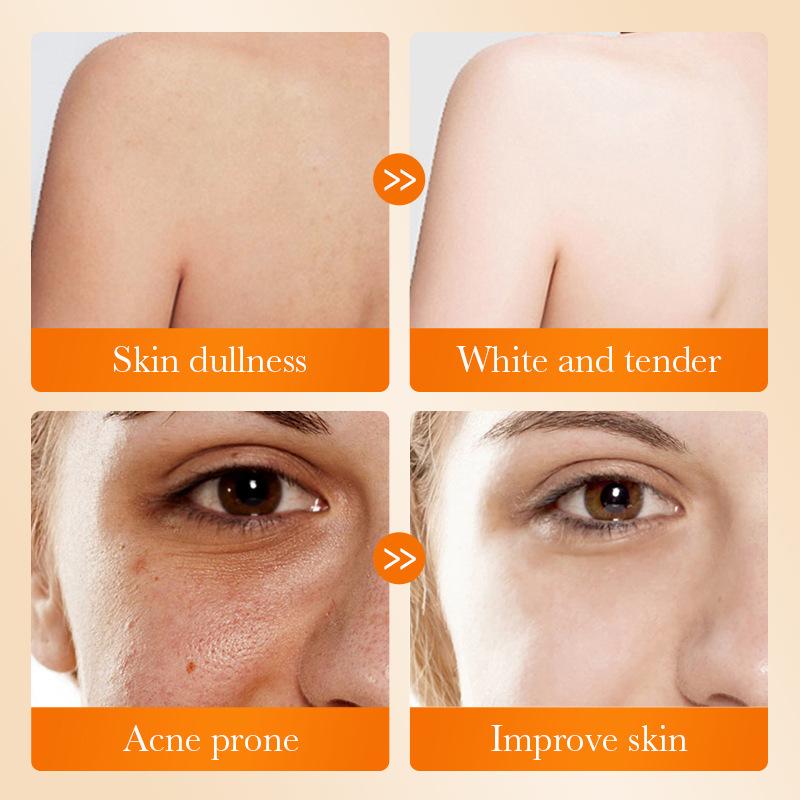 Jabón Facial SADOER con Ácido  - Kojic Acid Soap reseña y precio